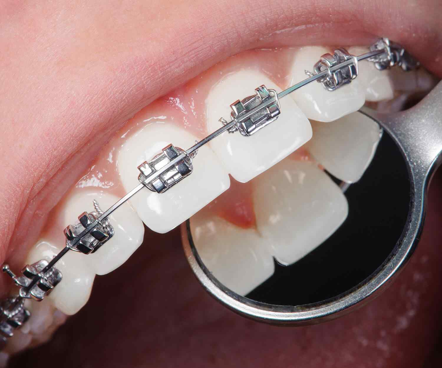 https://bpo.sysmetics.com/wp-content/uploads/2021/10/card_image_home_03-03-1.jpg